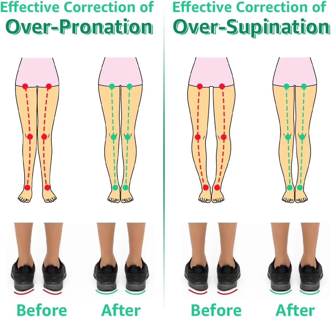 Skyfoot 3 Layers Adjustable Heel Wedge Inserts for Supination & Pronation Correction, Adhesive Medial & Lateral Heel Insoles for Bow Legs, Knee Pain, Foot Alignment (L: W 7-11, M 7-10, Black)